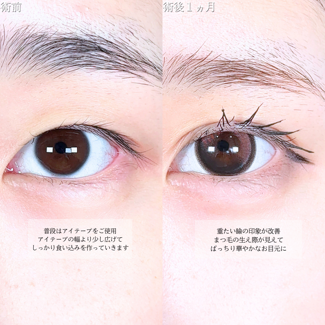 No.20821の症例写真1