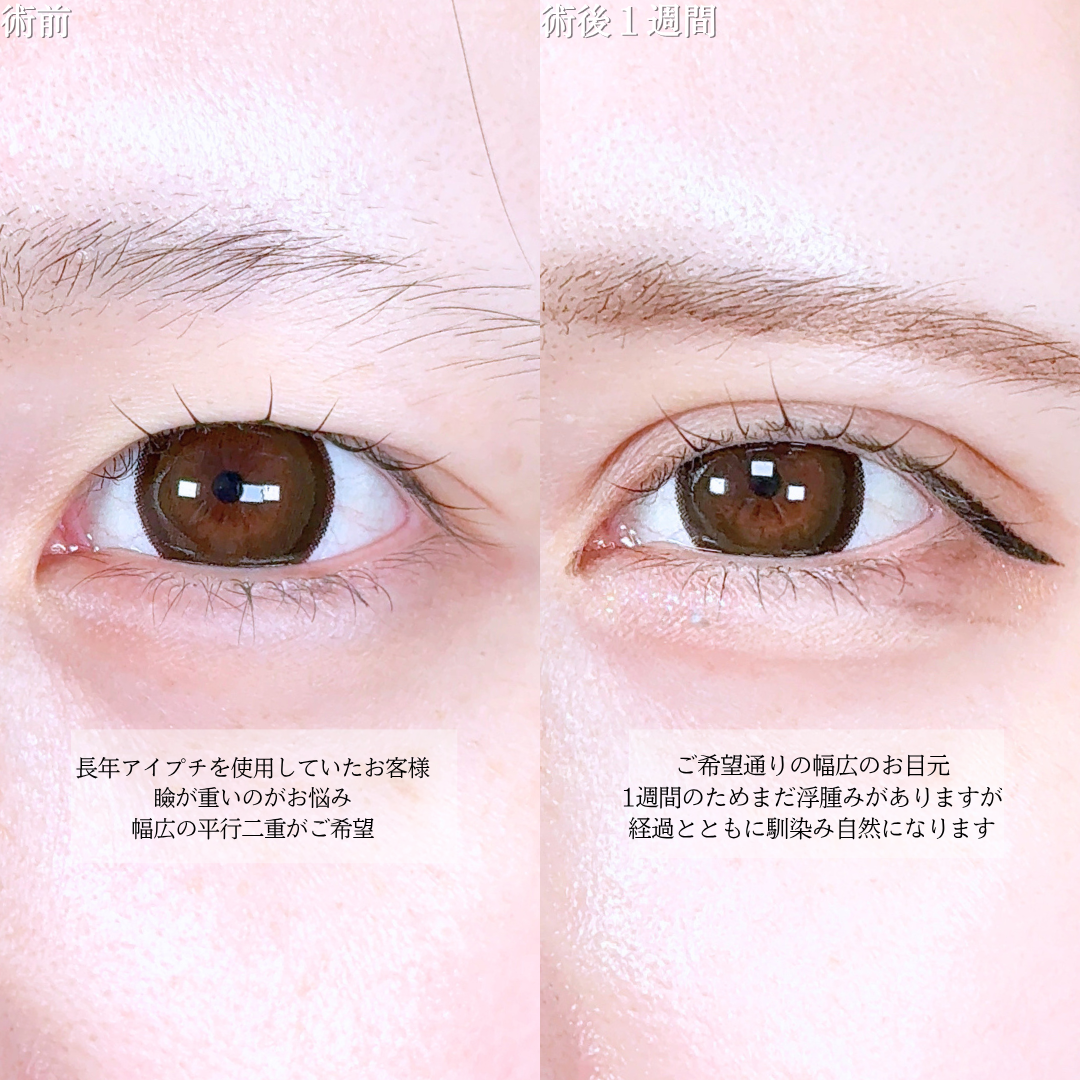 No.21041の症例写真1