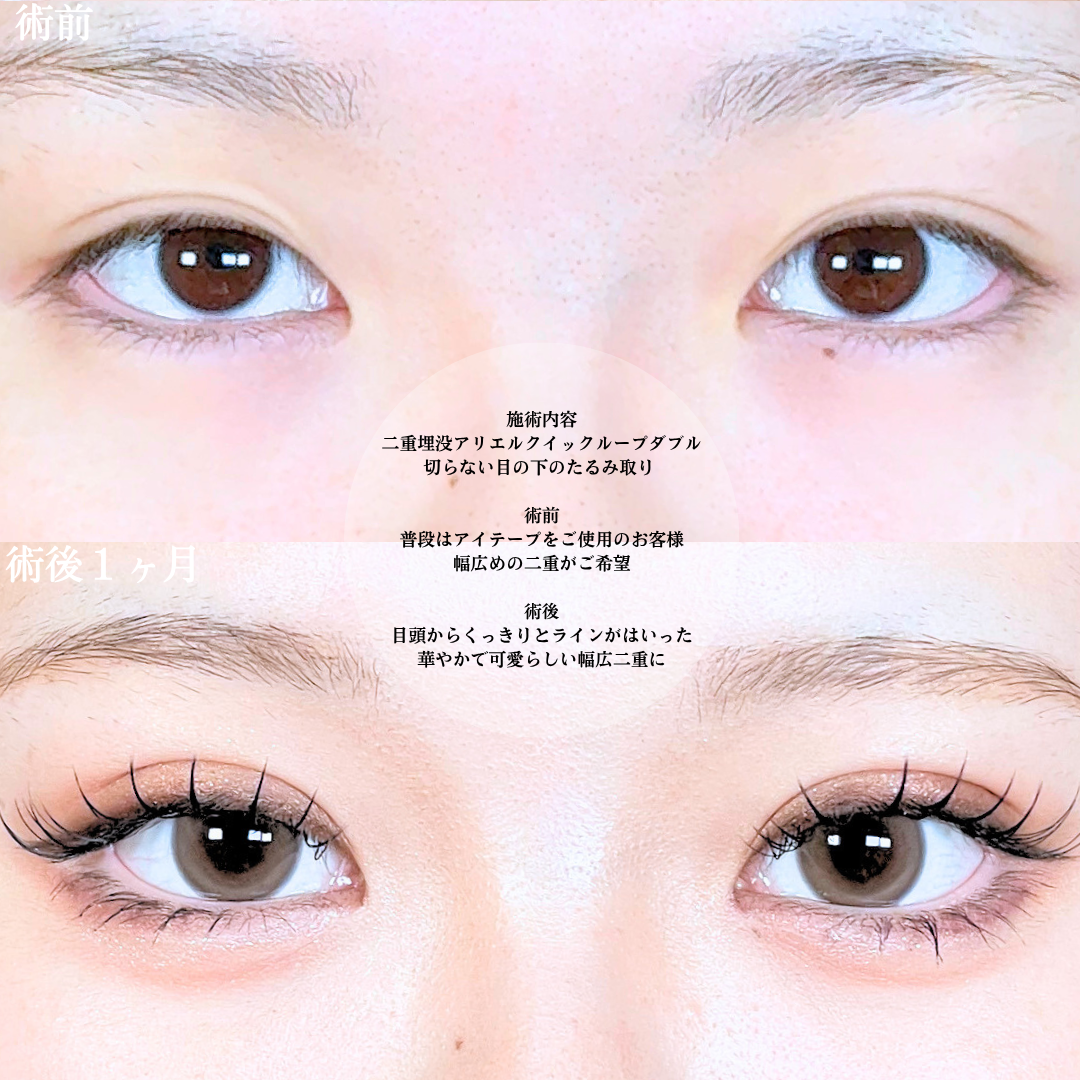 No.21103の症例写真1