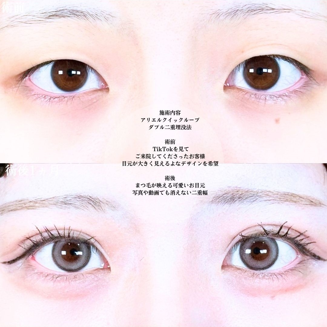 No.20696の症例写真1