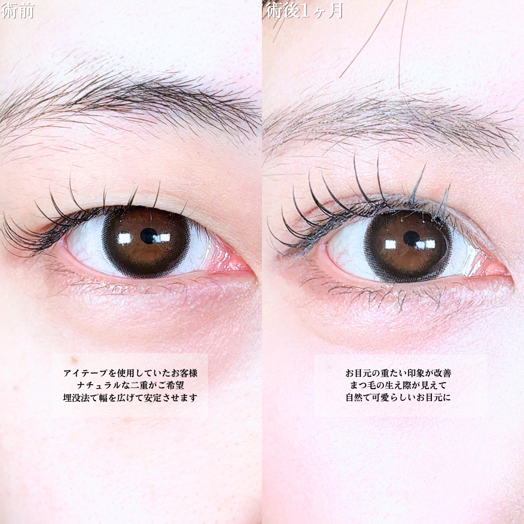 No.20634の症例写真1