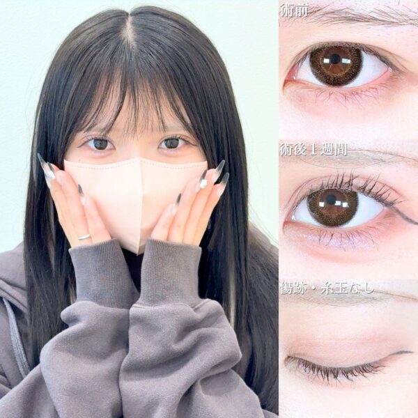 No.20790の症例写真