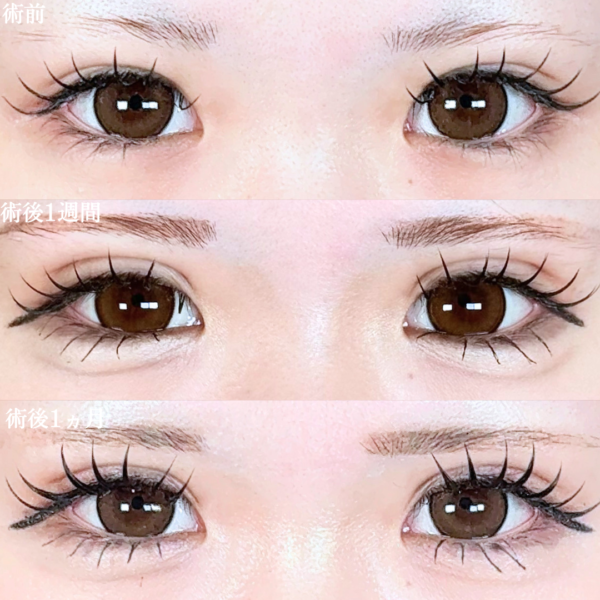 No.20654の症例写真 No.20654の症例写真