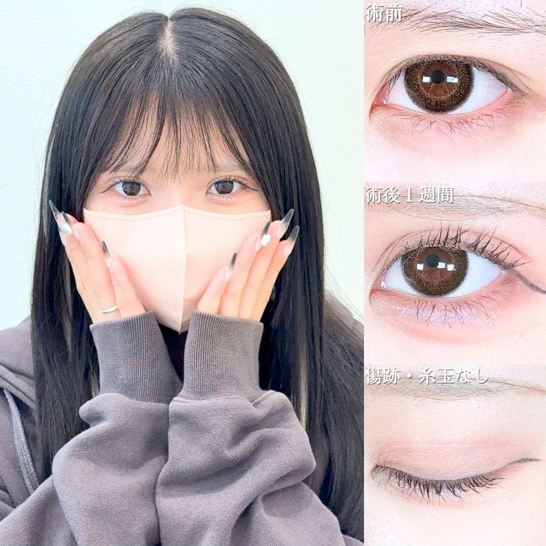 No.20790の症例写真