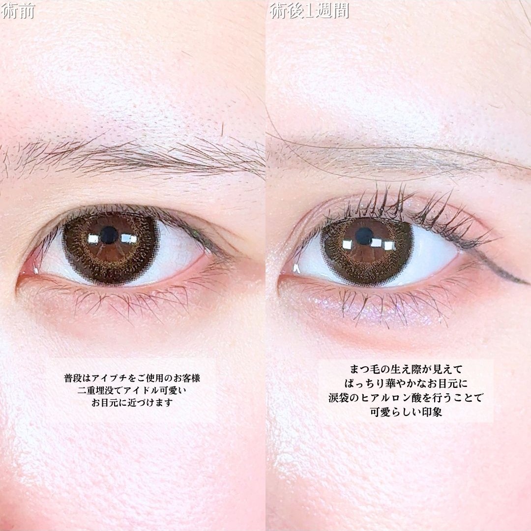 No.20790の症例写真1