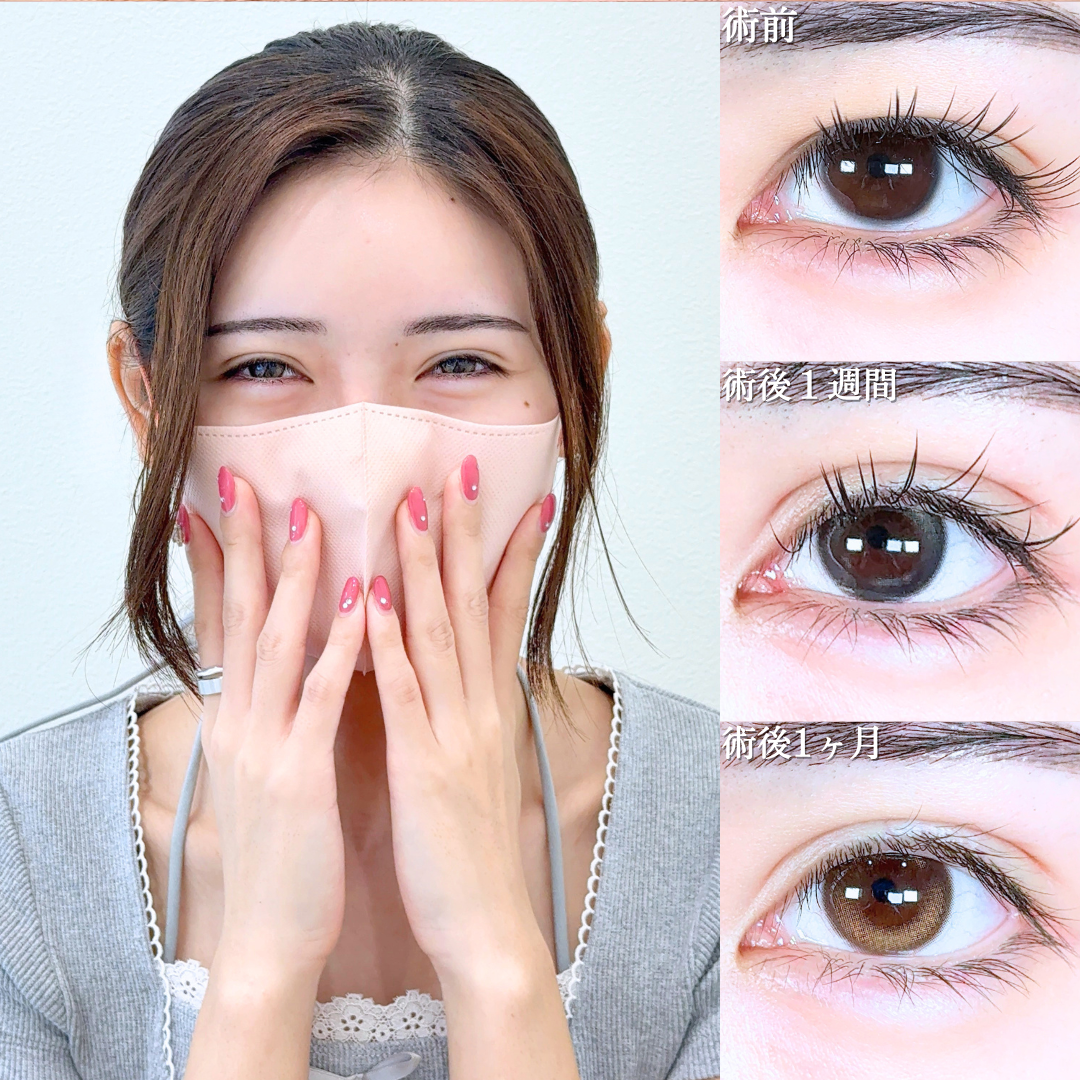 No.20686の症例写真