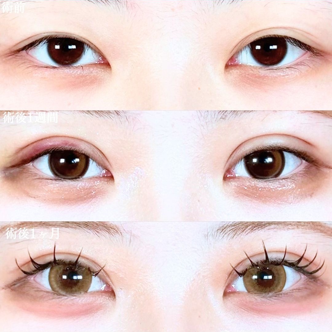 No.20848の症例写真