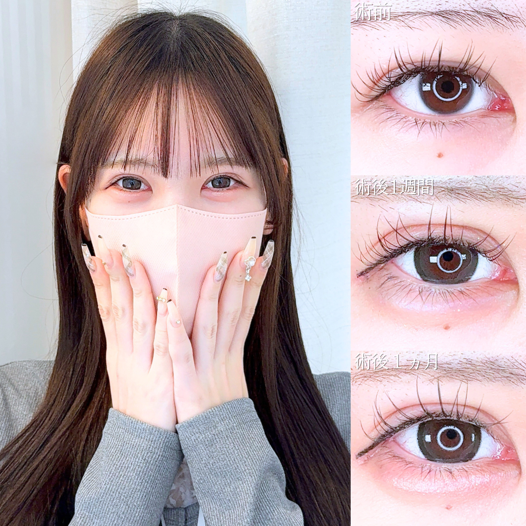 No.20692の症例写真