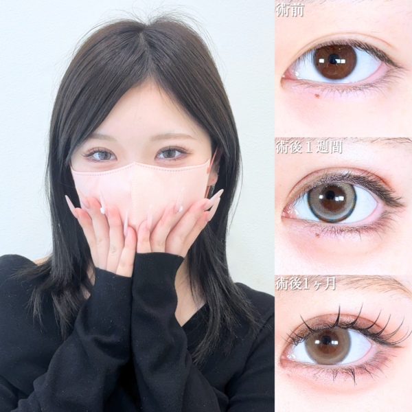 No.20749の症例写真