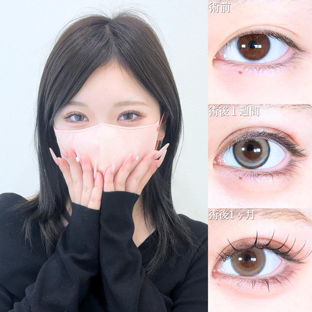 No.20749の症例写真