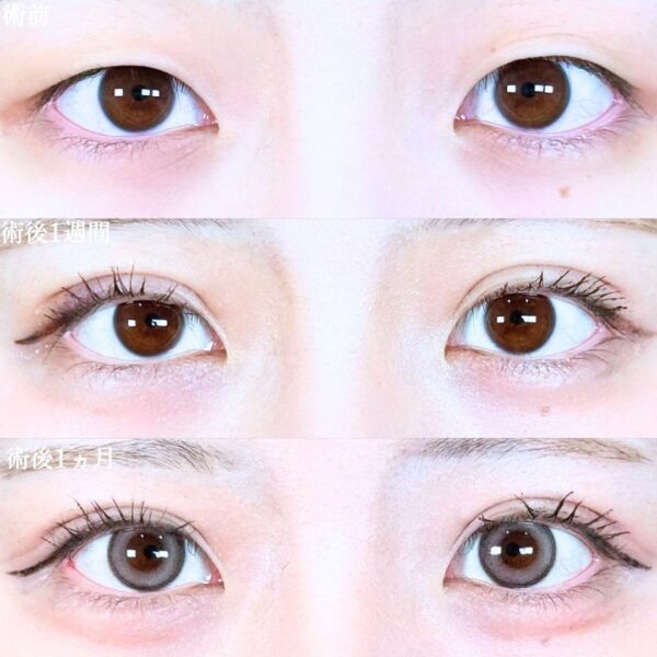 No.20696の症例写真