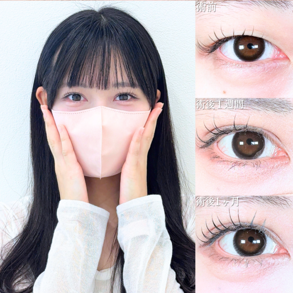 No.20634の症例写真 No.20634の症例写真