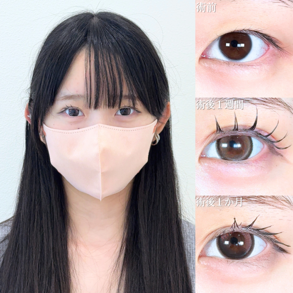 No.20821の症例写真