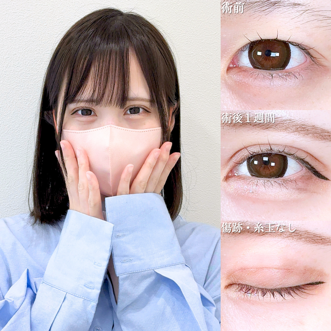 No.21041の症例写真