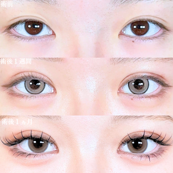 No.21103の症例写真