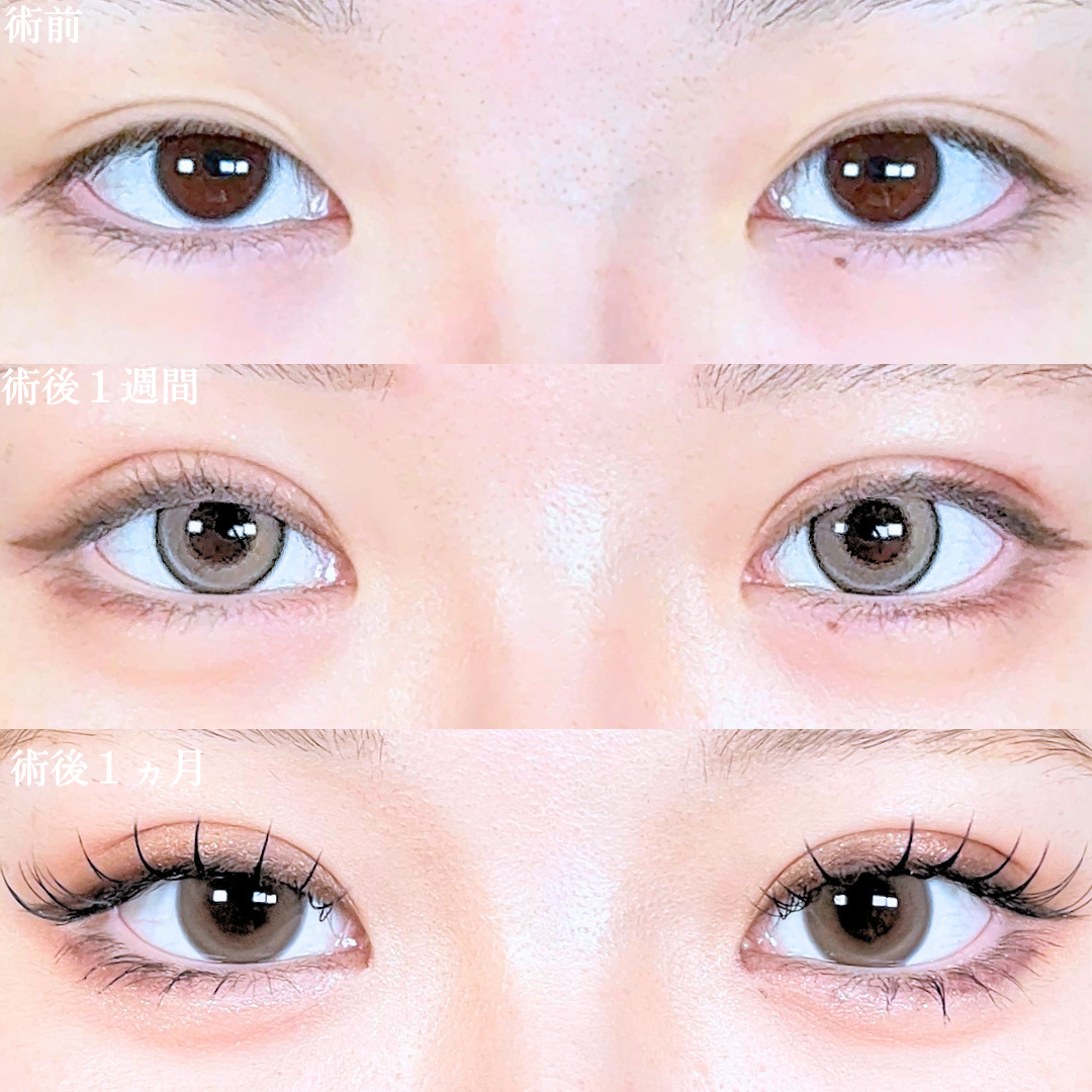 No.21103の症例写真