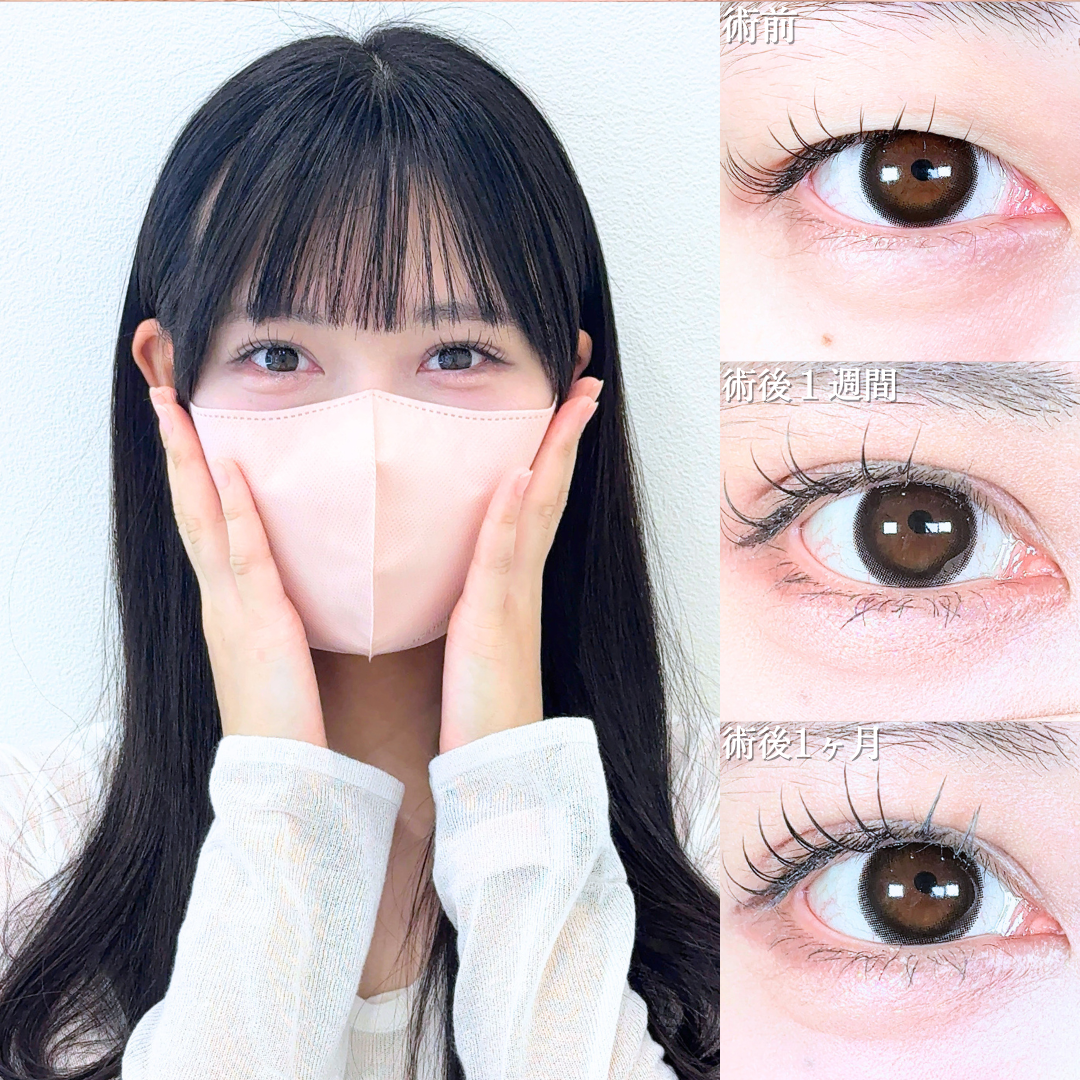 No.20634の症例写真