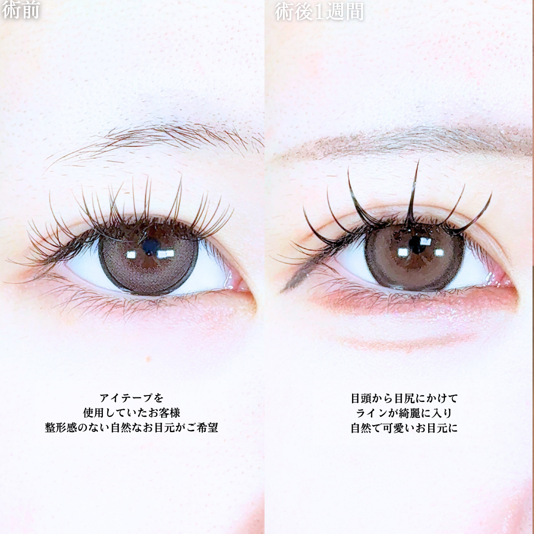 No.20878の症例写真1