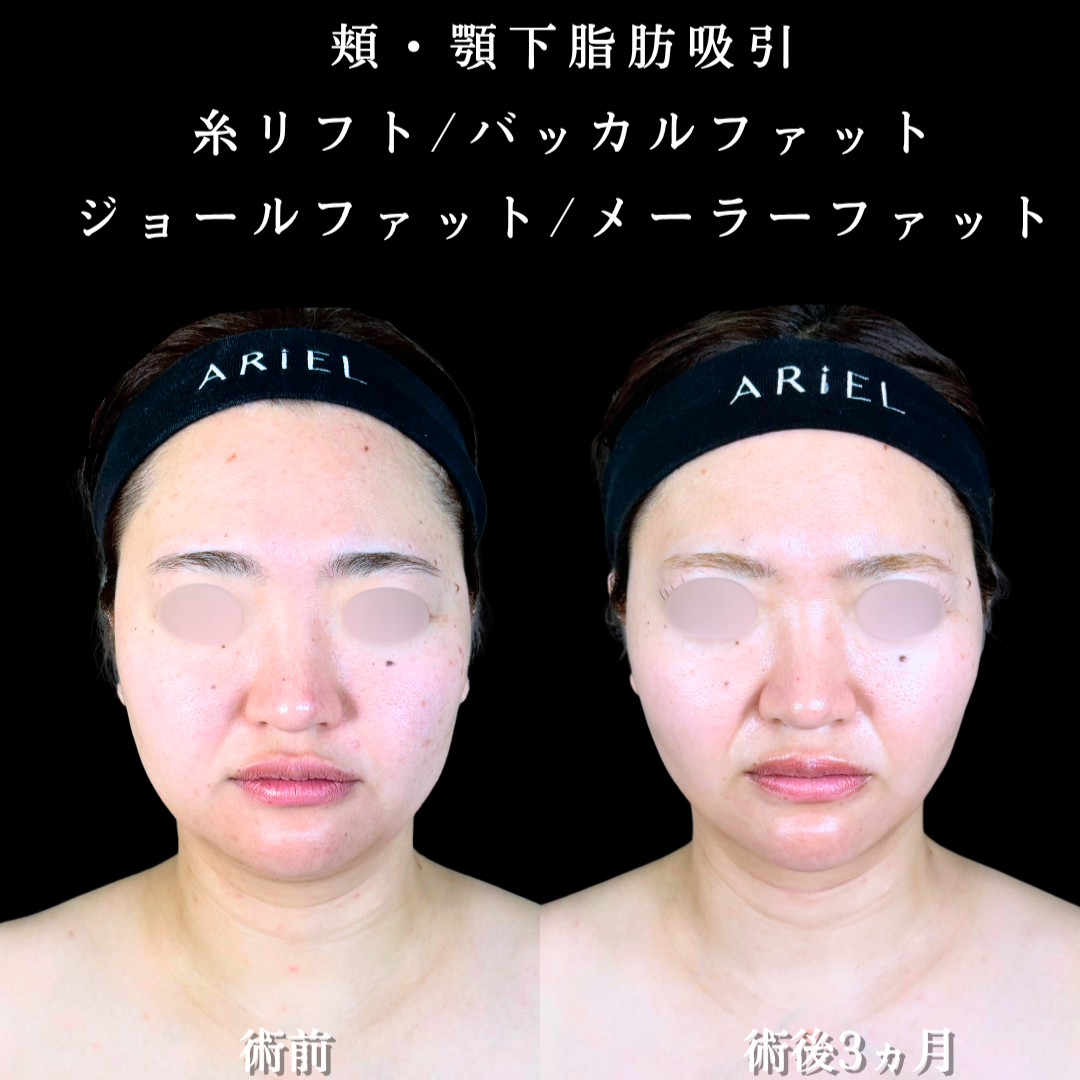 No.20840の症例写真2