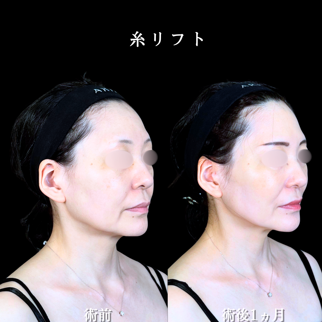 No.20656の症例写真2