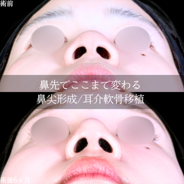No.25925の症例写真