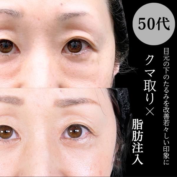 No.21147の症例写真