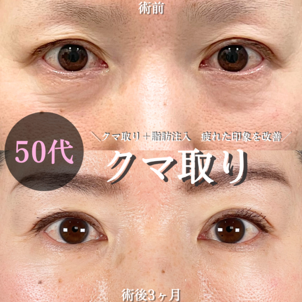 No.21290の症例写真