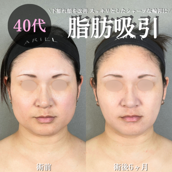 No.21329の症例写真