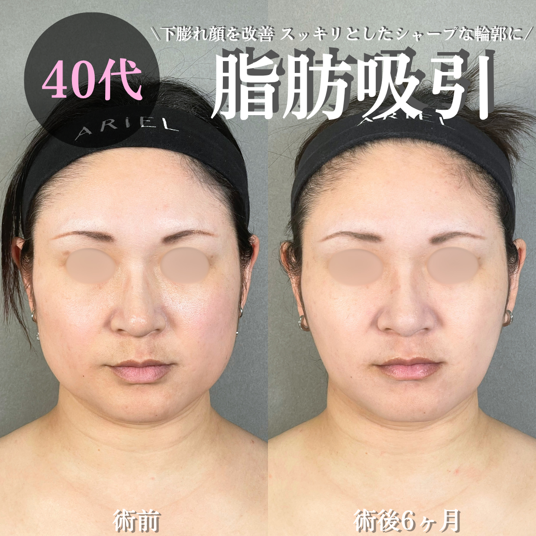 No.21329の症例写真