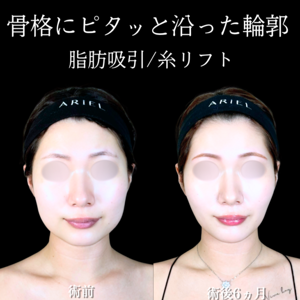 No.21347の症例写真