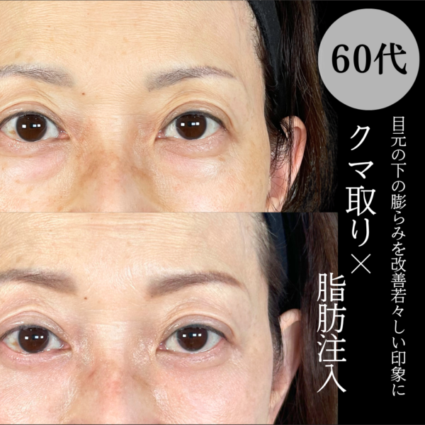 No.21354の症例写真