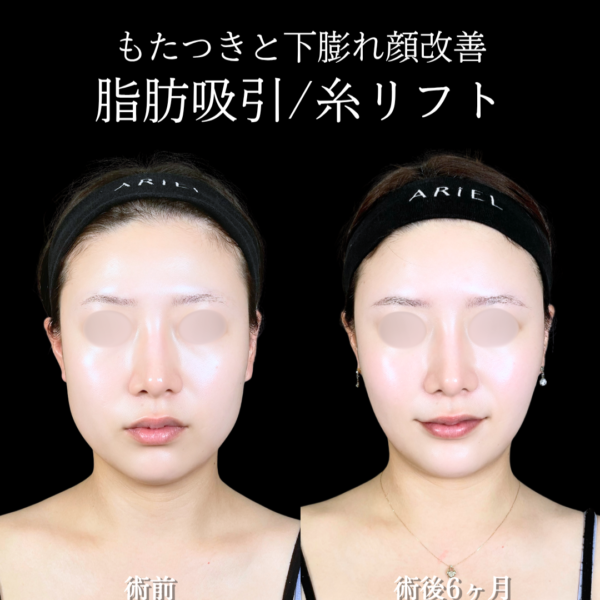 No.21380の症例写真