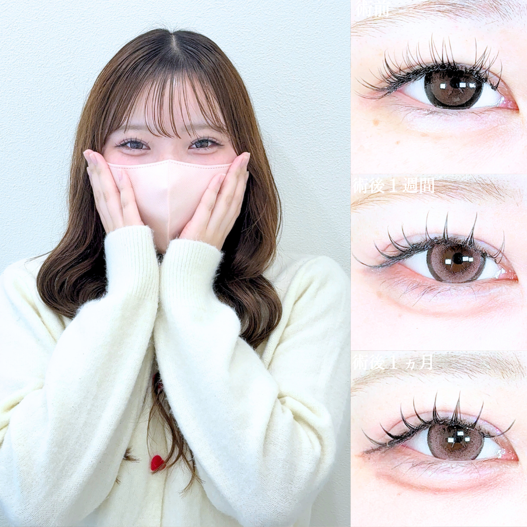 No.21456の症例写真