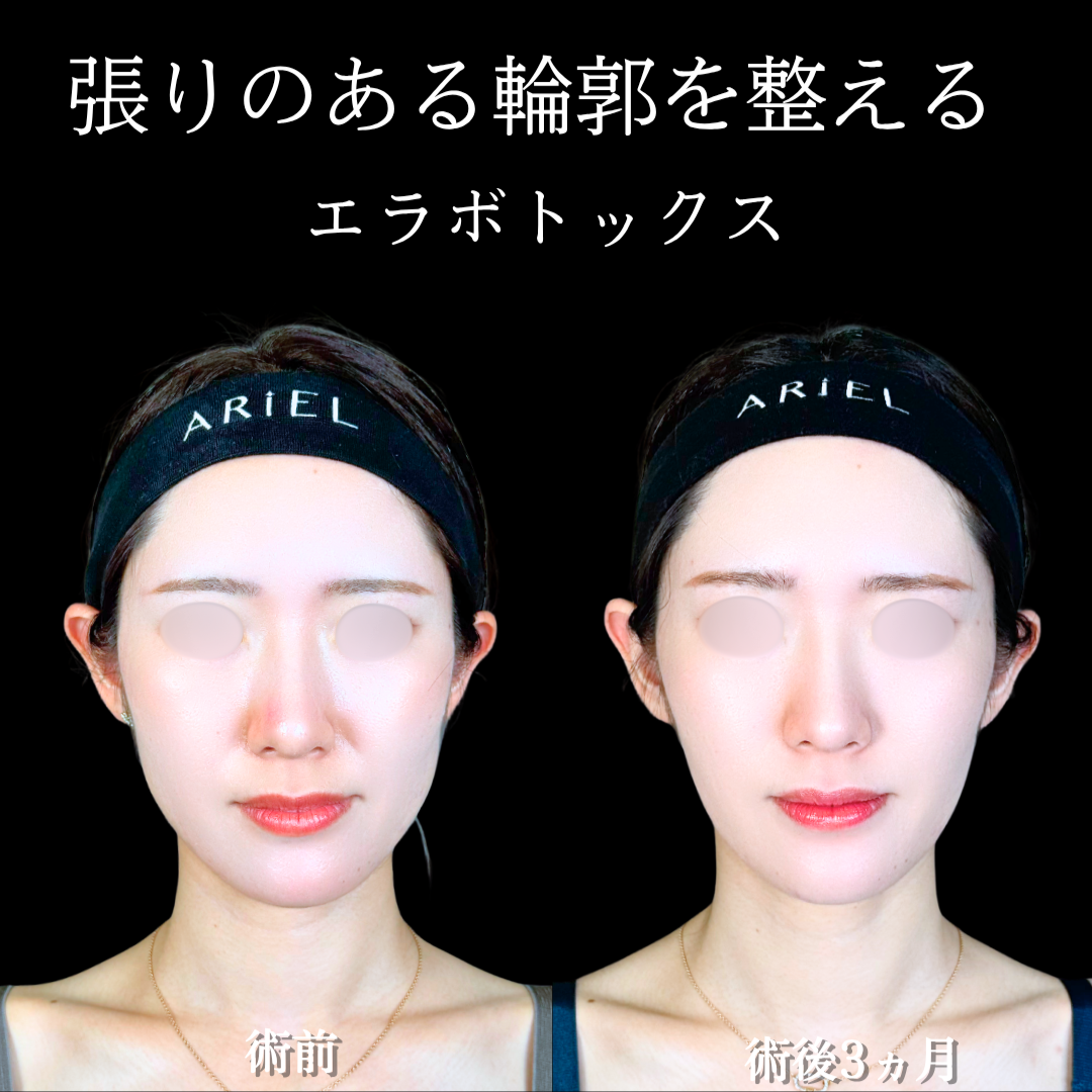 No.21463の症例写真