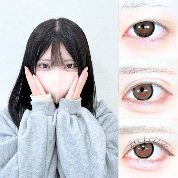 No.21500の症例写真