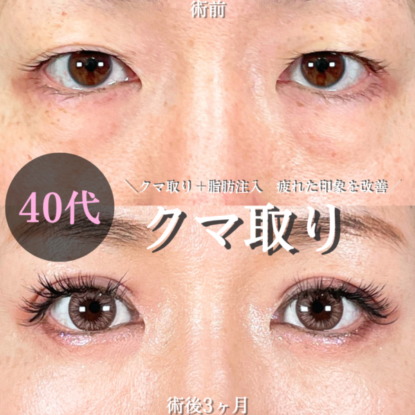 No.21507の症例写真