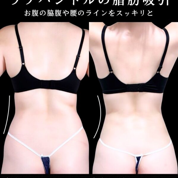 No.21322の症例写真
