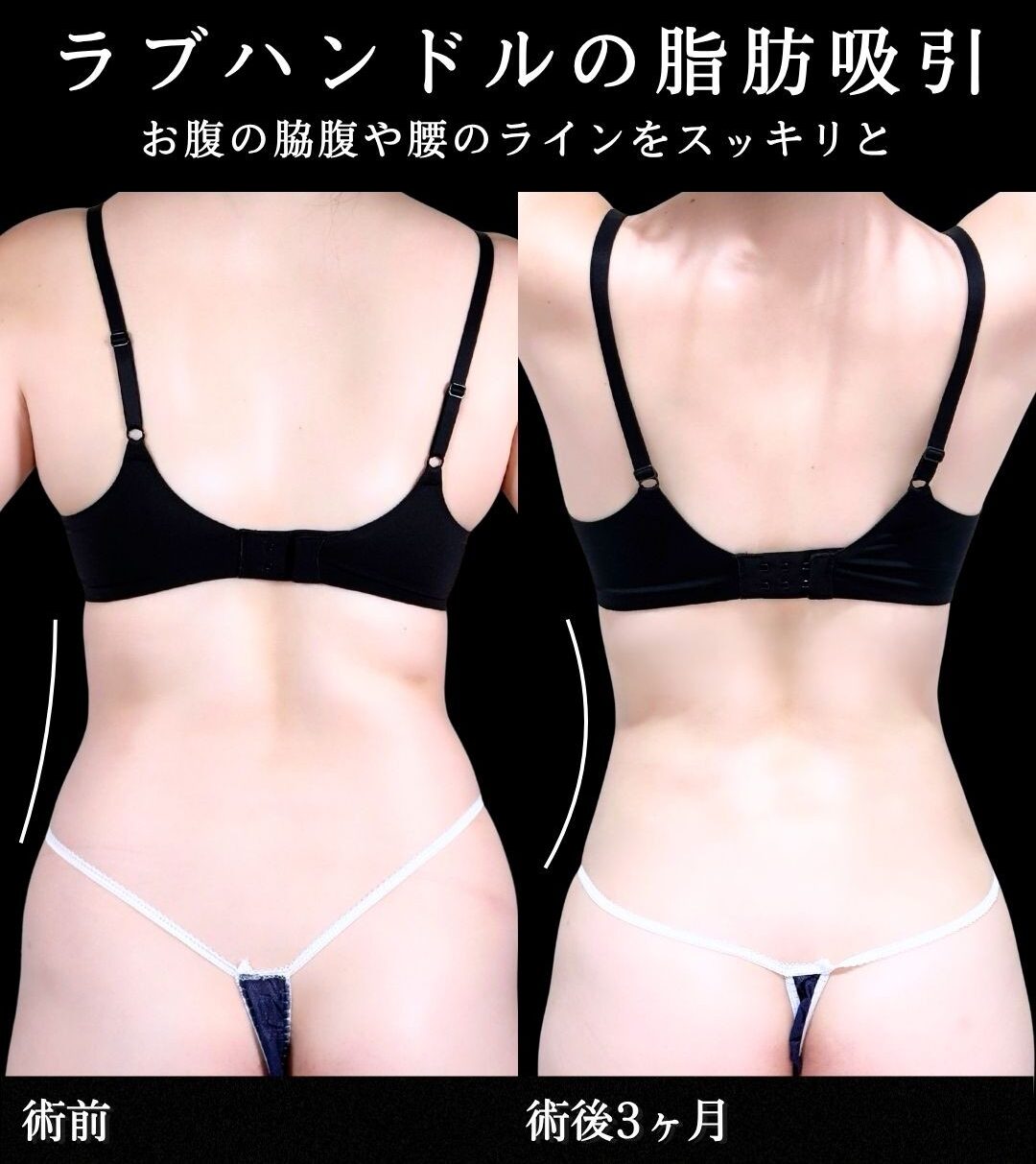 No.21322の症例写真