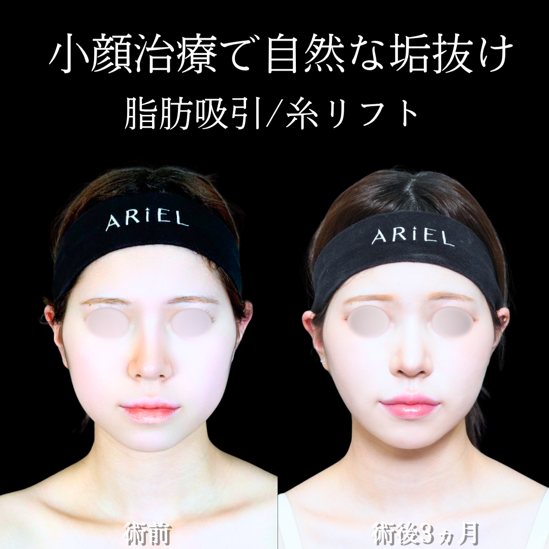 No.21161の症例写真