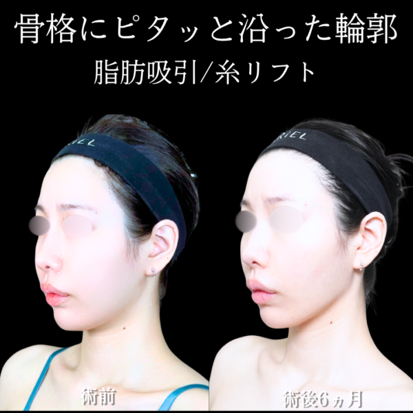 No.21581の症例写真