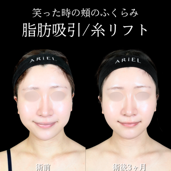 No.21572の症例写真