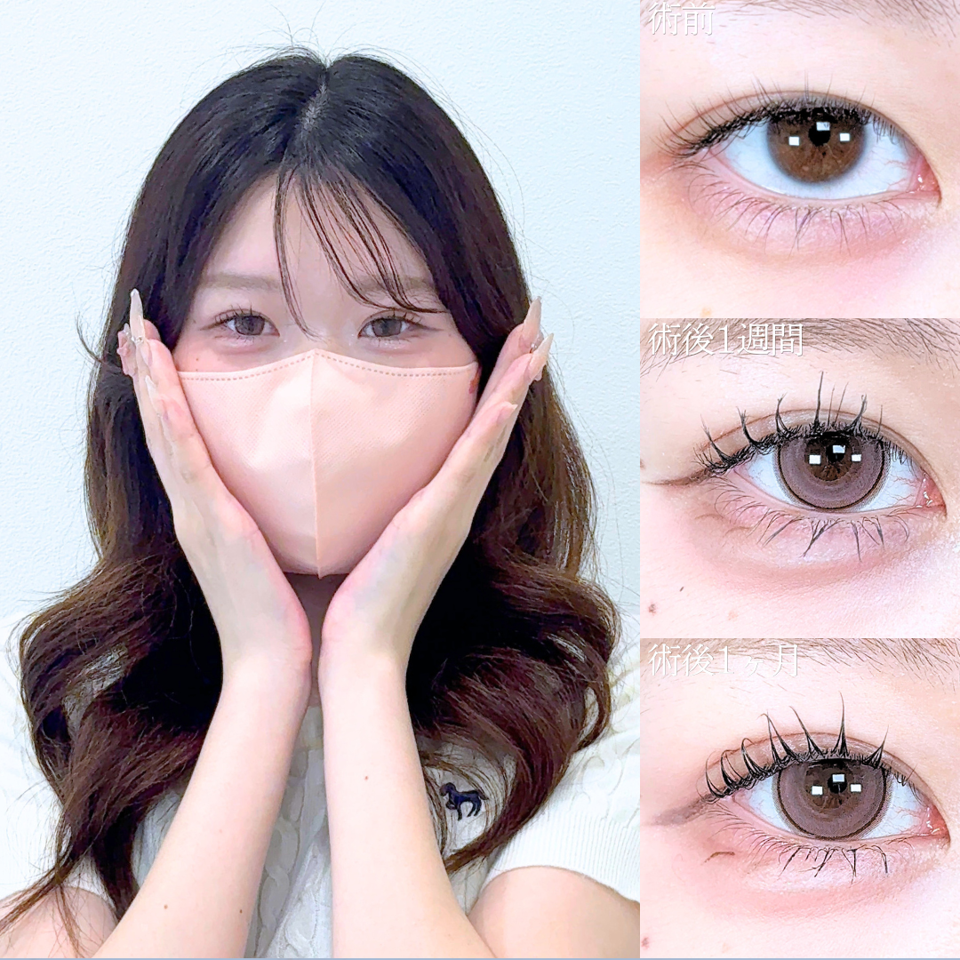 No.21608の症例写真