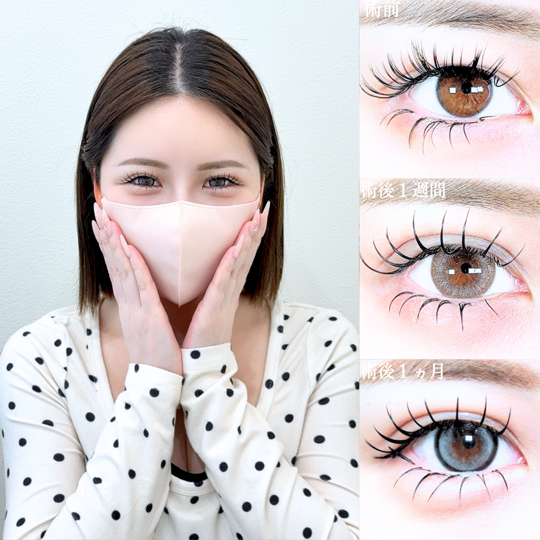 No.21635の症例写真