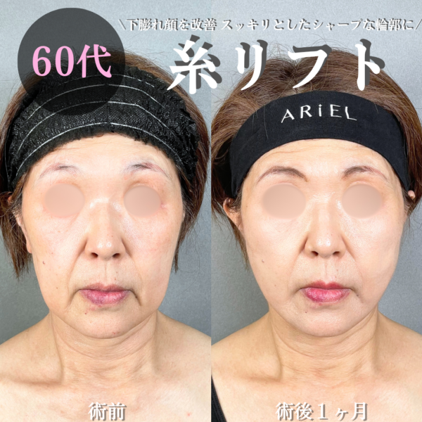No.21686の症例写真