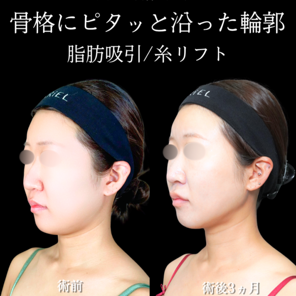 No.21792の症例写真