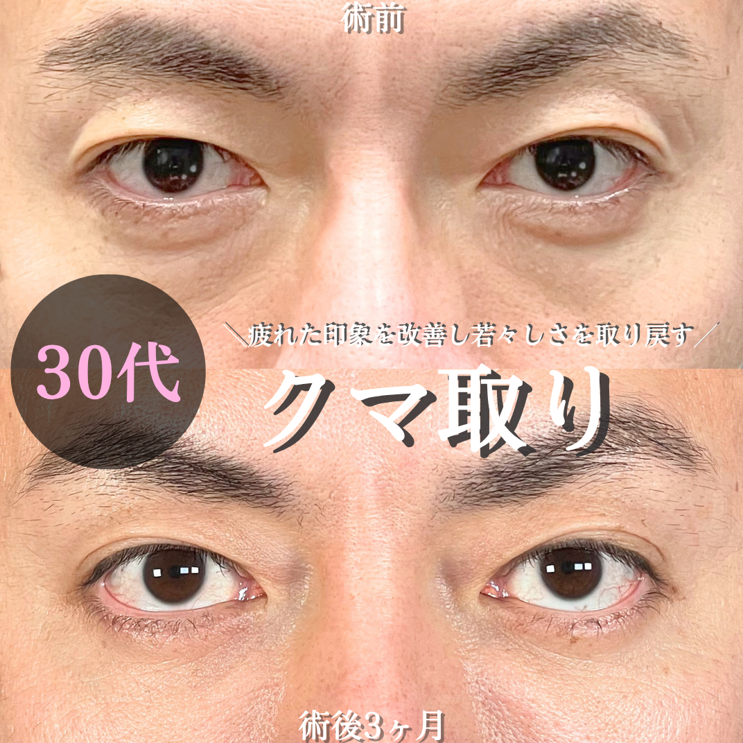 No.21832の症例写真