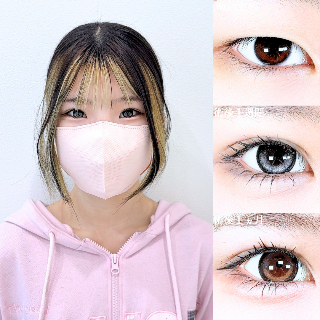 No.21857の症例写真