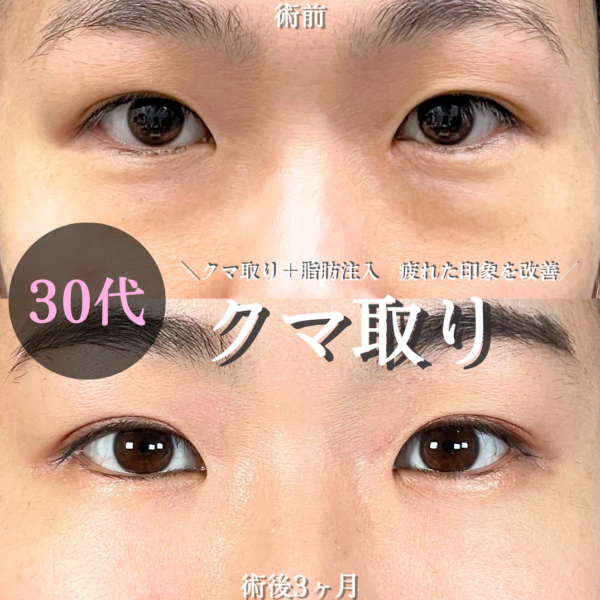 No.21168の症例写真