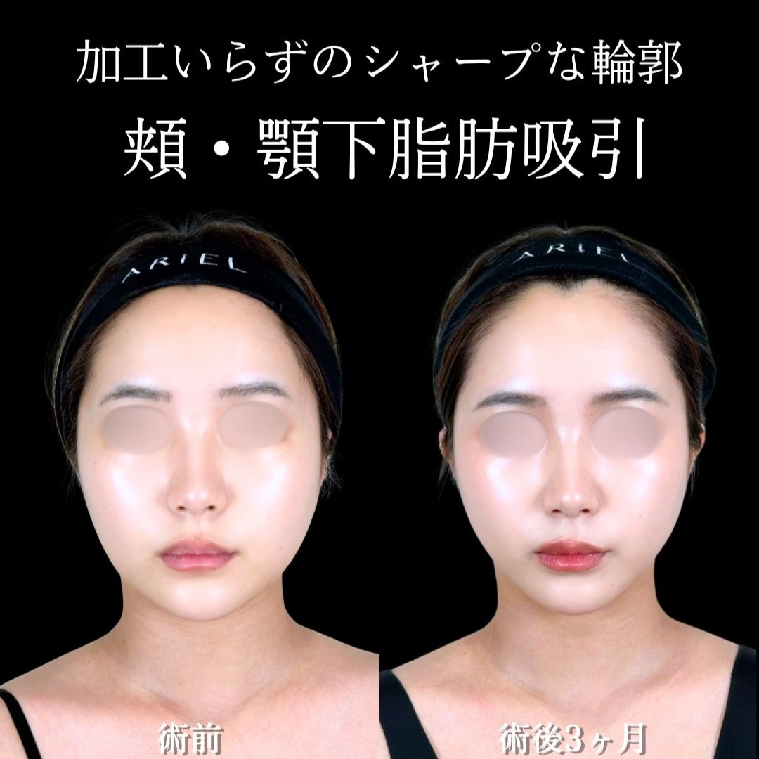No.21435の症例写真