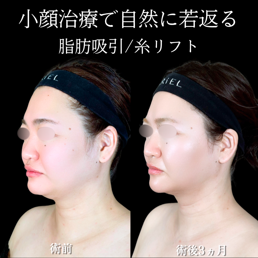 No.21865の症例写真